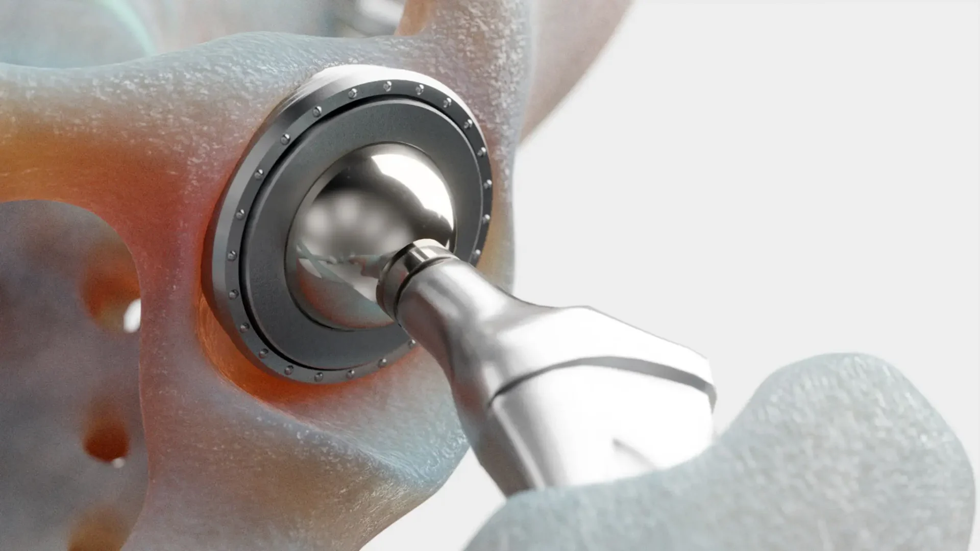 Close-up of a dental drill in a patient's mouth.